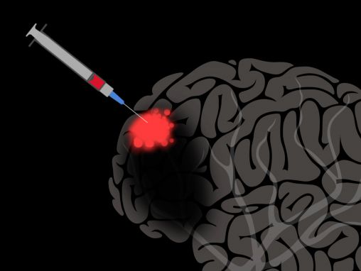 Click to play Jocelyne Bloch: El cerebro puede autorepararse con ayuda