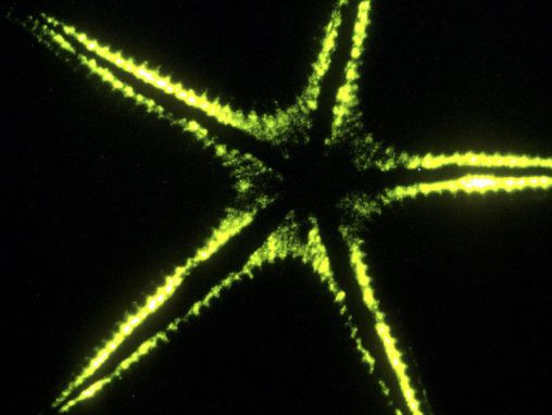 伊迪丝·威德：奇异而奇妙的生物发光世界