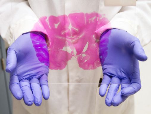 Click to play Allan Jones: Eine Karte des Gehirns